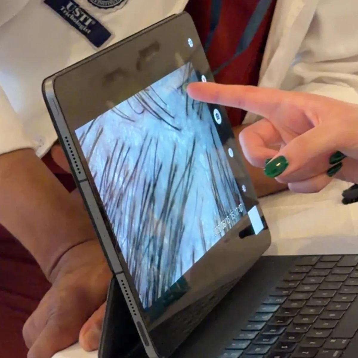 A trichologist showing a client a magnified scalp scan on a tablet